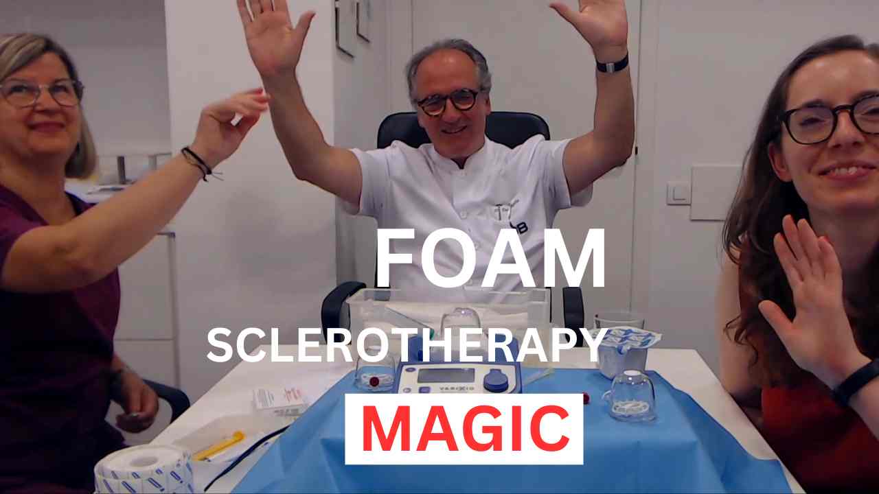 Ultrasound-guided-foam-sclerotherapy