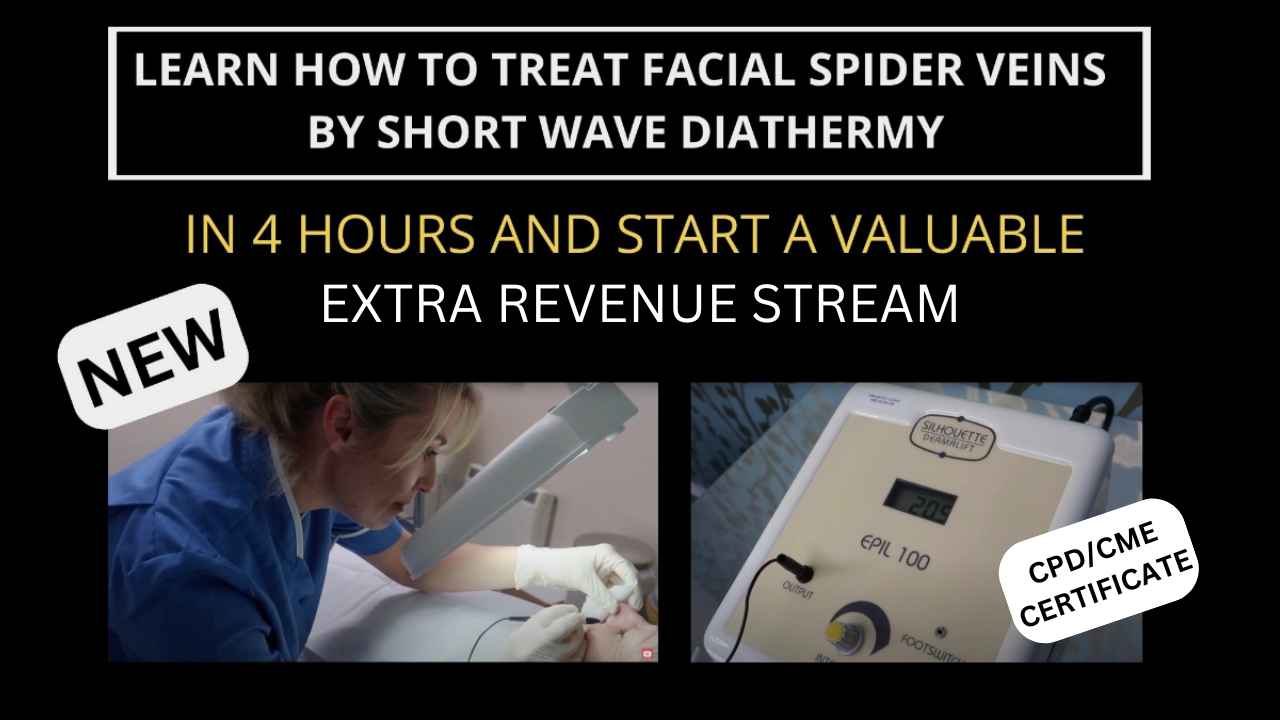 learn how to treat face spider veins