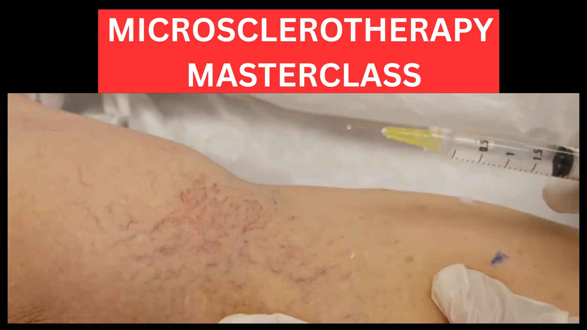 Microsclerotherapy-Training-Masterclass
