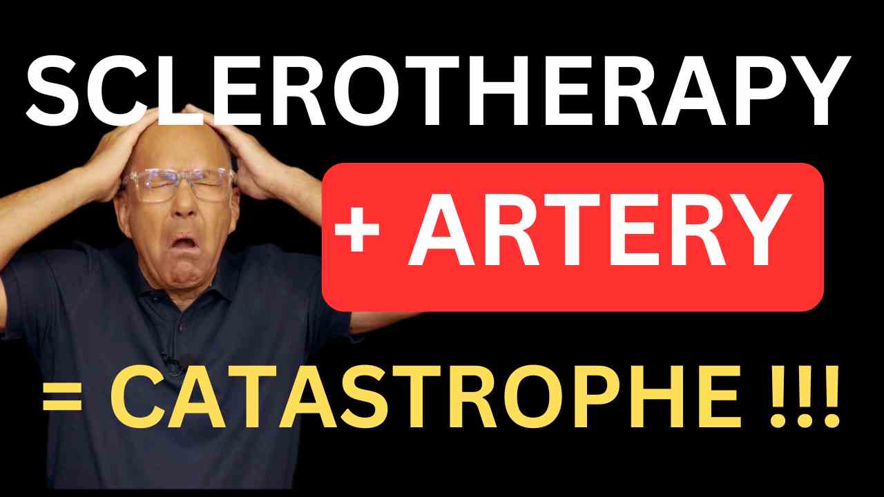intra-arterial-inection-during-sclerotherapy