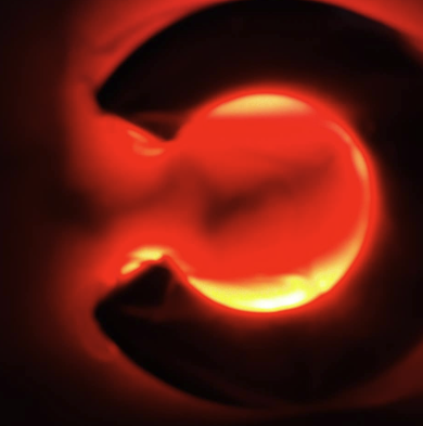 veinlite-sclerotherapy