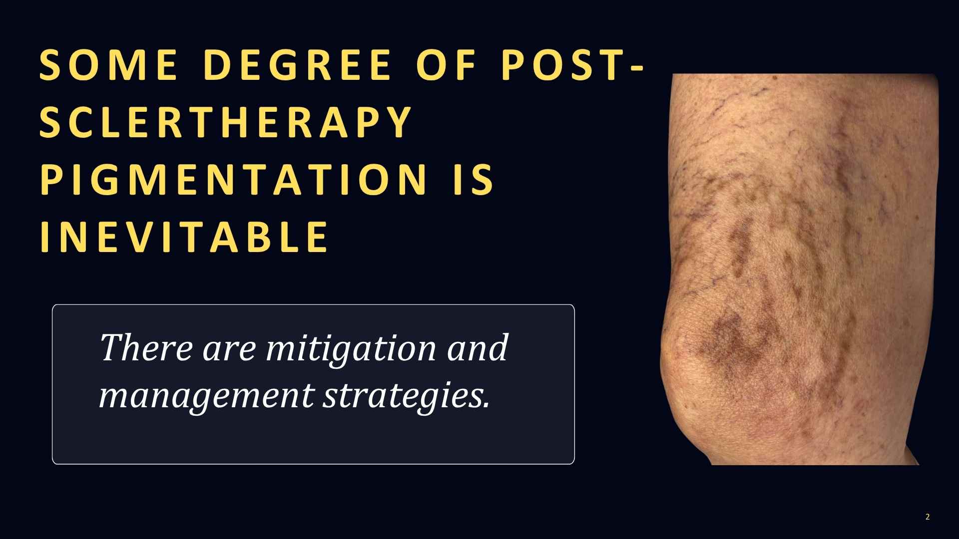 Post-sclerotherapy pigmentation prevention and management strategies 